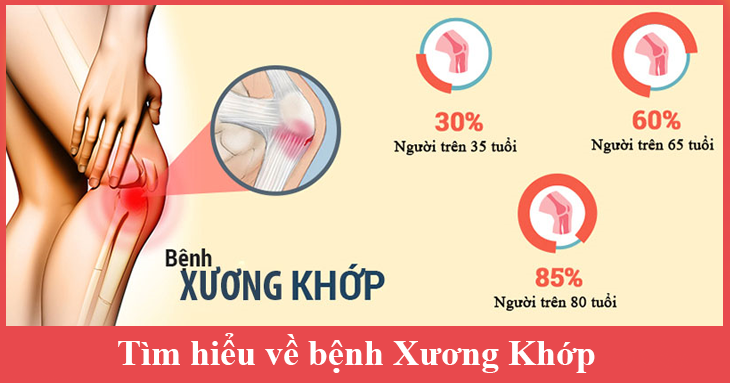 benh-xuong-khop