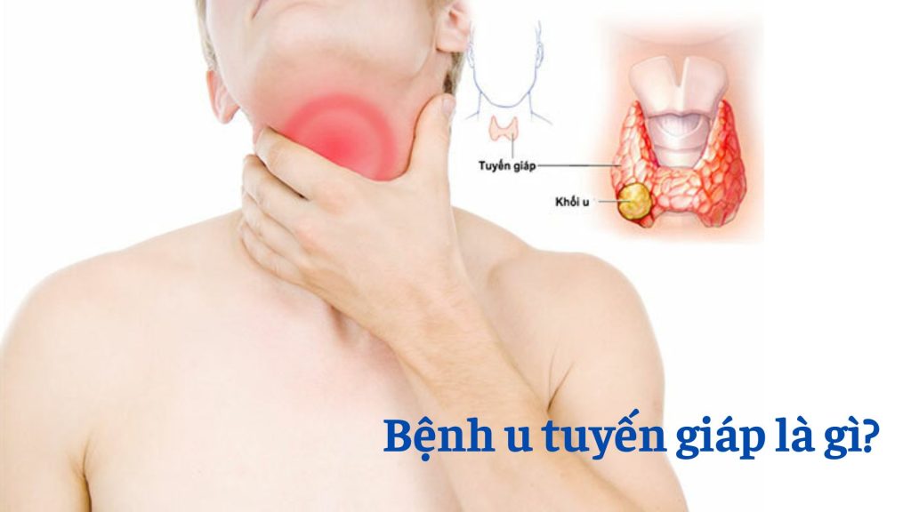 u-tuyen-giap